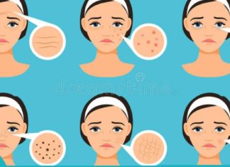 როგორ მოვიცილოთ ბუნებრივი გზით მეჭეჭი, გამონაყარი, მუქი და ასაკობრივი ლაქები?!