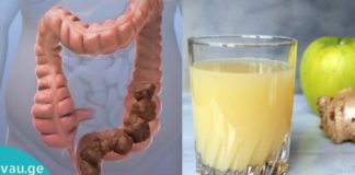 მსხვილი ნაწლავის გაწმენდა ვაშლის, ლიმონის, კოჭას წვენით და ზღვის მარილით