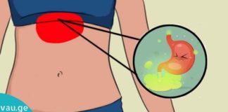 Როგორ შევინარჩუნოთ კუჭის ჯანმრთელობა წლების განმავლობაში