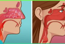 ჰაიმორიტის სამკურნალო მალამო – რა საშუალებები არაღ ვცადე – მხოლოდ ეს მალამო დამეხმარა!