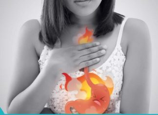 პროდუქტები, რომლებიც გიხსნით გულძმარვისგან