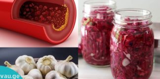 არტერიების ბუნებრივი გაწმენდის 5 მარტივი მეთოდი