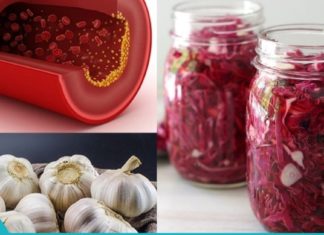 არტერიების ბუნებრივი გაწმენდის 5 მარტივი მეთოდი