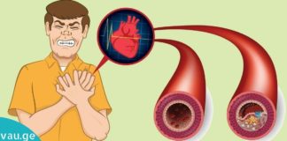 Ხალხური საშუალებები ათეროსკლეროზის სამკურნალოდ