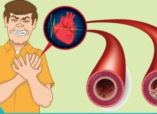 Ხალხური საშუალებები ათეროსკლეროზის სამკურნალოდ