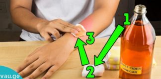 Როგორ დავაღწიოთ პაპილომას თავი?! უბრალოდ არ არსებობს ამაზე ეფექტური საშინაო საშუალება