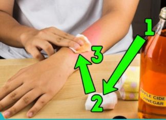 Როგორ დავაღწიოთ პაპილომას თავი?! უბრალოდ არ არსებობს ამაზე ეფექტური საშინაო საშუალება