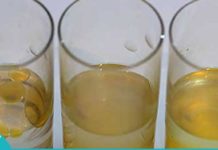 არაყი და ზეთი- უნიკალური ნაზავი მრავალი დაავადების წინააღმდეგ