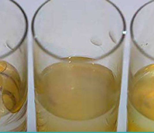 არაყი და ზეთი- უნიკალური ნაზავი მრავალი დაავადების წინააღმდეგ