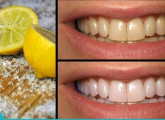ლიმონის გამოყენების 4 გზა პირის ღრუს პრობლემების გადასაჭრელად