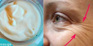 სახლში დამზადებული Ნაოჭების საწინააღმდეგო სახის კრემი – შედეგი ჩანს 7 დღეში!