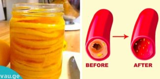 ძველი გერმანული რეცეპტი სისხლძარღვების გასაწმენდად! რეცეპტი, რომელმაც საუკუნეებს გაუძლო!