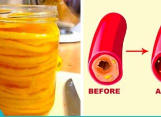 ძველი გერმანული რეცეპტი სისხლძარღვების გასაწმენდად! რეცეპტი, რომელმაც საუკუნეებს გაუძლო!