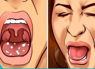თუ ამ ნაყენს გამოივლებთ პირის ღრუში, უსიამოვნო სუნი გაქრება!