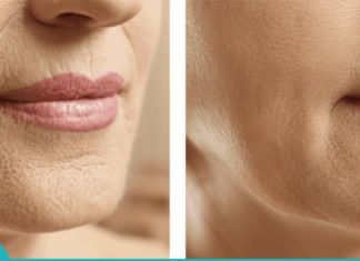 ყველაზე ეფექტური ნიღაბი ნაოჭების წინააღმდეგ–  საოცარი შედეგი 5 პროცედურის შემდეგ!