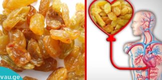 Ქიშმიშით მკურნალობა: ჰიპერტენზიის, ღვიძლის და ნაღვლის დაავადებების, ხველისა და ყელის ტკივილის დროს