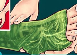 კომბოსტოს კომპრესი: სახსრების ტკივილის, შეშუპების, ანთების დროს