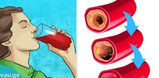 10 პროდუქტი, რომელიც დაგეხმარებათ არტერიების გასუფთავებაში