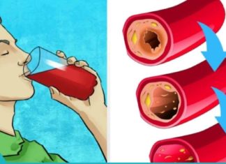 10 პროდუქტი, რომელიც დაგეხმარებათ არტერიების გასუფთავებაში