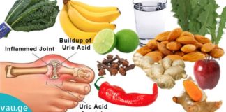 ტოპ-6 ხილი, რაც ხელს უწყობს შარდმჟავის დონის შემცირებას