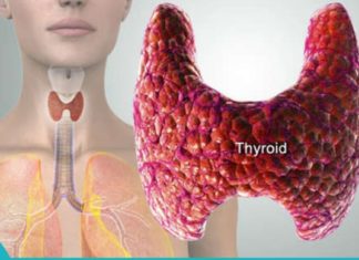 თუ ფარისებრი ჯირკვალი ჯანმრთელია – მთელი სხეული ჯანმრთელია! რა უნდა გავაკეთოთ ამისათვის?