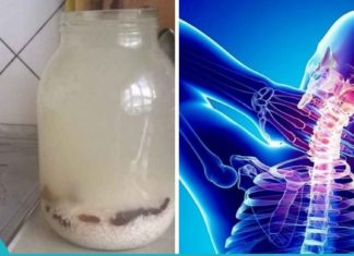 გემრიელი ბრინჯის კვასის მომზადება, რაც შეამცირებს ზურგის ტკივილს ოსტეოქონდროზის დროს