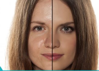 საუკეთესო ნიღაბი ცხიმიანი კანისთვის