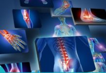 საკვები, რომლის მიღებაც აუცილებლად უნდა გამოირიცხოს ართრიტის დროს