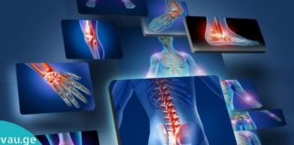 საკვები, რომლის მიღებაც აუცილებლად უნდა გამოირიცხოს ართრიტის დროს