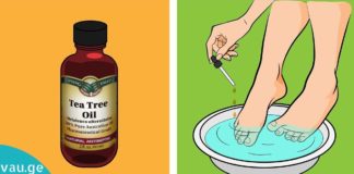 Ძალიან სასარგებლო რჩევები ჩაის ხის ზეთის გამოყენების შესახებ