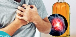 Როგორ ავიცილოთ თავიდან გულის დაავადება და ინსულტი