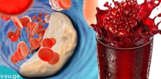 კვლევებმა დაადასტურა, რომ ბროწეული უფრო ეფექტურია, ვიდრე მაღალი ქოლესტერინის დამწევი მედიკამენტები!