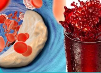 კვლევებმა დაადასტურა, რომ ბროწეული უფრო ეფექტურია, ვიდრე მაღალი ქოლესტერინის დამწევი მედიკამენტები!