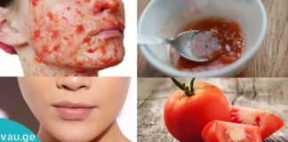 თუ დაჭრილ პომიდორს წაისვამთ სახეზე 3 წამის განმავლობაში, თქვენ მიიღებთ დაუჯერებელ ეფექტს!