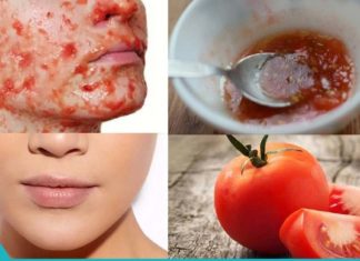 თუ დაჭრილ პომიდორს წაისვამთ სახეზე 3 წამის განმავლობაში, თქვენ მიიღებთ დაუჯერებელ ეფექტს!