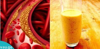 ეს ბუნებრივი სმუზი დაგეხმარებათ სისხლში ქოლესტერინისა და არტერიული წნევის დარეგულირებაში