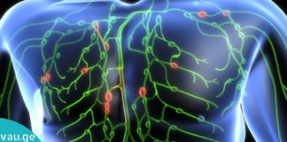 თქვენი ლიმფური სისტემის გაწმენდის 10 მარტივი გზა- მხოლოდ ბუნებრივი საშუალებებით