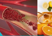 გაისუფთავებთ სიახლძარღვები თაფლის, ფორთოხალისა და ლიმონის კომბინაციით