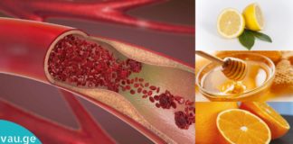 გაისუფთავებთ სიახლძარღვები თაფლის, ფორთოხალისა და ლიმონის კომბინაციით