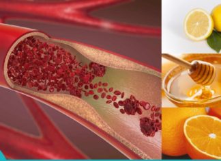 გაისუფთავებთ სიახლძარღვები თაფლის, ფორთოხალისა და ლიმონის კომბინაციით