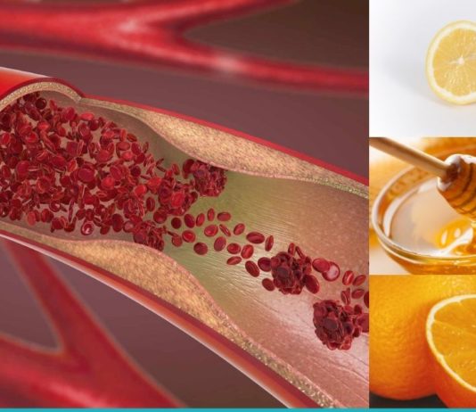 გაისუფთავებთ სიახლძარღვები თაფლის, ფორთოხალისა და ლიმონის კომბინაციით