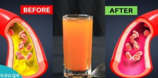 ინფუზიები, რომლებიც ადვილად ასუფთავებენ ვენებსა და არტერიებს!