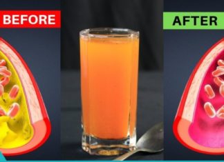 ინფუზიები, რომლებიც ადვილად ასუფთავებენ ვენებსა და არტერიებს!