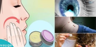 რას კურნავს აბუსალათინის ზეთი?!