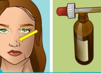 მხოლოდ ამ ზეთს შეუძლია გაგათავისუფლოთ ნაოჭებისგან