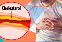 4 დღის განმავლობაში ცუდი ქოლესტერინის შემცირების ბუნებრივი გზები