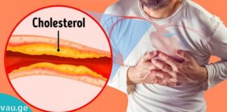 4 დღის განმავლობაში ცუდი ქოლესტერინის შემცირების ბუნებრივი გზები