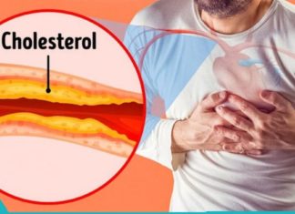 4 დღის განმავლობაში ცუდი ქოლესტერინის შემცირების ბუნებრივი გზები