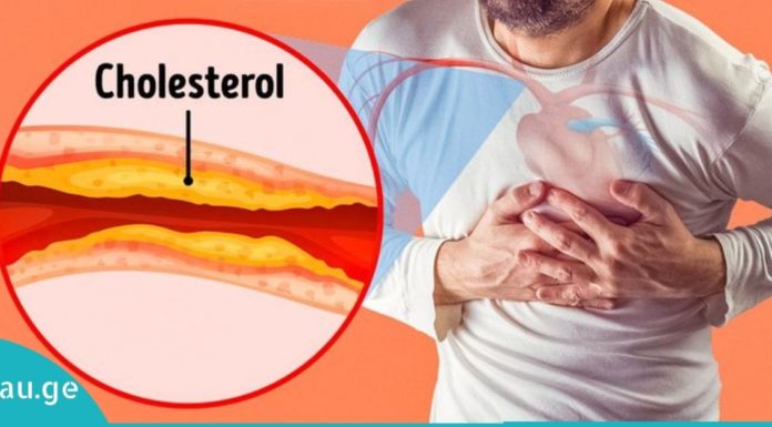 4 დღის განმავლობაში ცუდი ქოლესტერინის შემცირების ბუნებრივი გზები