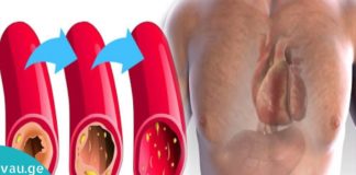 ეს პროდუქტები საოცარად ეხმარება არტერიებს ბაქტერიების გამოდევნაში. უმოკლეს დროში აჯანსაღებს არტერიებს.